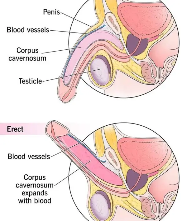 Erectile Issues